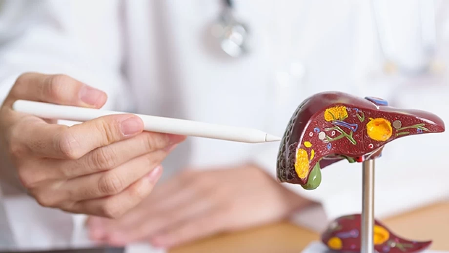 فیبروز کبدی و آزمایشات غیرتهاجمی